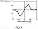Fig. 09 - PAM-4 Baud-rate clock and data recovery circuit using stochastic phase detection technique