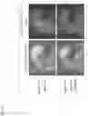 Fig. 04 - ORGAN REGENERATION METHOD UTILIZING iPS CELL AND BLASTOCYST COMPLEMENTATION