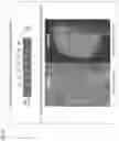 Fig. 08 - ORGAN REGENERATION METHOD UTILIZING iPS CELL AND BLASTOCYST COMPLEMENTATION