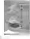 Fig. 09 - ORGAN REGENERATION METHOD UTILIZING iPS CELL AND BLASTOCYST COMPLEMENTATION