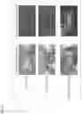 Fig. 10 - ORGAN REGENERATION METHOD UTILIZING iPS CELL AND BLASTOCYST COMPLEMENTATION