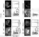 Fig. 12 - ORGAN REGENERATION METHOD UTILIZING iPS CELL AND BLASTOCYST COMPLEMENTATION