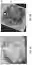 Fig. 11 - SYSTEMS AND METHODS FOR PERFUSING A HUMAN PLACENTA-BASED MRI PHANTOM
