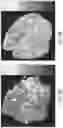 Fig. 13 - SYSTEMS AND METHODS FOR PERFUSING A HUMAN PLACENTA-BASED MRI PHANTOM