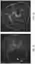 Fig. 14 - SYSTEMS AND METHODS FOR PERFUSING A HUMAN PLACENTA-BASED MRI PHANTOM