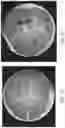Fig. 15 - SYSTEMS AND METHODS FOR PERFUSING A HUMAN PLACENTA-BASED MRI PHANTOM