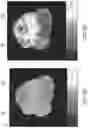 Fig. 19 - SYSTEMS AND METHODS FOR PERFUSING A HUMAN PLACENTA-BASED MRI PHANTOM