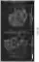 Fig. 20 - SYSTEMS AND METHODS FOR PERFUSING A HUMAN PLACENTA-BASED MRI PHANTOM