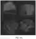 Fig. 21 - SYSTEMS AND METHODS FOR PERFUSING A HUMAN PLACENTA-BASED MRI PHANTOM