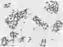 Fig. 01 - PROBIOTIC FOR INHIBITING GROWTH OF PROTEUS MIRABILIS, AND FERMENTATION BROTH AND APPLICATION THEREOF