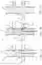 Fig. 02 - Endovascular orifice detection device for accurate fenestrated stent graft deployment