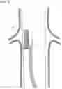 Fig. 11 - Endovascular orifice detection device for accurate fenestrated stent graft deployment