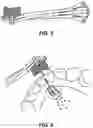 Fig. 03 - FLUID BASED TOOTH CLEANING SYSTEM