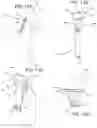 Fig. 13 - EXTRA ORAL DENTAL VENTILATOR