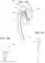 Fig. 14 - EXTRA ORAL DENTAL VENTILATOR