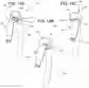 Fig. 16 - EXTRA ORAL DENTAL VENTILATOR