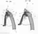 Fig. 18 - EXTRA ORAL DENTAL VENTILATOR