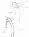 Fig. 20 - EXTRA ORAL DENTAL VENTILATOR