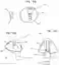 Fig. 22 - EXTRA ORAL DENTAL VENTILATOR