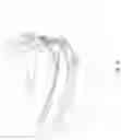 Fig. 10 - ORAL CARE SYSTEM FOR INTERDENTAL SPACE DETECTION