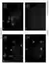 Fig. 20 - MOTILE CELL SORTING DEVICE