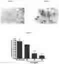 Fig. 02 - COMPOSITIONS FOR EFFECTIVE MANAGEMENT OF FIBROBLAST-LIKE SYNOVIOCYTES MEDIATED RHEUMATOID ARTHRITIS