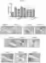 Fig. 08 - COMPOSITIONS FOR EFFECTIVE MANAGEMENT OF FIBROBLAST-LIKE SYNOVIOCYTES MEDIATED RHEUMATOID ARTHRITIS
