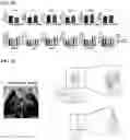 Fig. 21 - Immunotherapeutic Nanoparticles And Methods Relating Thereto