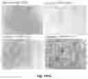Fig. 23 - Cross-linked hyaluronic acids and combinations with PRP/BMC
