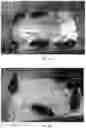 Fig. 03 - METHODS OF TREATING IMBALANCE OF PLASMA LIPIDS LEVEL AND FATTY LIVER WITH M2C MACROPHAGES