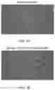 Fig. 05 - METHODS OF TREATING IMBALANCE OF PLASMA LIPIDS LEVEL AND FATTY LIVER WITH M2C MACROPHAGES