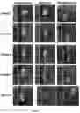 Fig. 10 - METHODS OF TREATING IMBALANCE OF PLASMA LIPIDS LEVEL AND FATTY LIVER WITH M2C MACROPHAGES