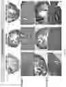 Fig. 11 - METHODS OF TREATING IMBALANCE OF PLASMA LIPIDS LEVEL AND FATTY LIVER WITH M2C MACROPHAGES
