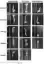Fig. 15 - METHODS OF TREATING IMBALANCE OF PLASMA LIPIDS LEVEL AND FATTY LIVER WITH M2C MACROPHAGES