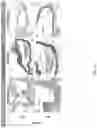 Fig. 16 - METHODS OF TREATING IMBALANCE OF PLASMA LIPIDS LEVEL AND FATTY LIVER WITH M2C MACROPHAGES
