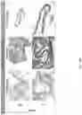 Fig. 17 - METHODS OF TREATING IMBALANCE OF PLASMA LIPIDS LEVEL AND FATTY LIVER WITH M2C MACROPHAGES