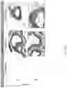 Fig. 19 - METHODS OF TREATING IMBALANCE OF PLASMA LIPIDS LEVEL AND FATTY LIVER WITH M2C MACROPHAGES