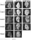 Fig. 20 - METHODS OF TREATING IMBALANCE OF PLASMA LIPIDS LEVEL AND FATTY LIVER WITH M2C MACROPHAGES