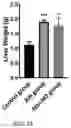 Fig. 21 - METHODS OF TREATING IMBALANCE OF PLASMA LIPIDS LEVEL AND FATTY LIVER WITH M2C MACROPHAGES