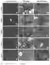 Fig. 23 - METHODS OF TREATING IMBALANCE OF PLASMA LIPIDS LEVEL AND FATTY LIVER WITH M2C MACROPHAGES