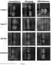 Fig. 24 - METHODS OF TREATING IMBALANCE OF PLASMA LIPIDS LEVEL AND FATTY LIVER WITH M2C MACROPHAGES