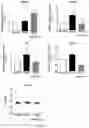 Fig. 27 - METHODS OF TREATING IMBALANCE OF PLASMA LIPIDS LEVEL AND FATTY LIVER WITH M2C MACROPHAGES