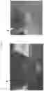 Fig. 02 - WASHED PLATELET EXTRACT