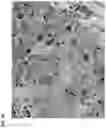 Fig. 20 - COMPOSITIONS COMPRISING STEM CELLS EXPRESSING MESENCHYMAL AND NEURONAL MARKERS AND USES THEREOF TO TREAT NEUROLOGICAL DISEASE