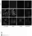 Fig. 31 - COMPOSITIONS COMPRISING STEM CELLS EXPRESSING MESENCHYMAL AND NEURONAL MARKERS AND USES THEREOF TO TREAT NEUROLOGICAL DISEASE