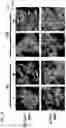 Fig. 06 - COMPOSITIONS AND METHODS FOR TARGETING TUMOR-ASSOCIATED EXTRACELLULAR MATRIX COMPONENTS TO IMPROVE DRUG DELIVERY