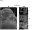 Fig. 11 - COMPOSITIONS AND METHODS FOR TARGETING TUMOR-ASSOCIATED EXTRACELLULAR MATRIX COMPONENTS TO IMPROVE DRUG DELIVERY