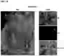 Fig. 12 - COMPOSITIONS AND METHODS FOR TARGETING TUMOR-ASSOCIATED EXTRACELLULAR MATRIX COMPONENTS TO IMPROVE DRUG DELIVERY