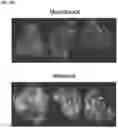 Fig. 13 - COMPOSITIONS AND METHODS FOR TARGETING TUMOR-ASSOCIATED EXTRACELLULAR MATRIX COMPONENTS TO IMPROVE DRUG DELIVERY