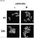 Fig. 19 - COMPOSITIONS AND METHODS FOR TARGETING TUMOR-ASSOCIATED EXTRACELLULAR MATRIX COMPONENTS TO IMPROVE DRUG DELIVERY